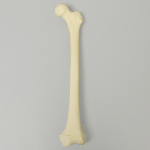 Femur with Defined Distal Growth Plate