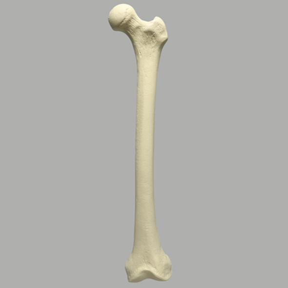 Femur, 12 mm Canal, Foam Cortical, Left, Medium