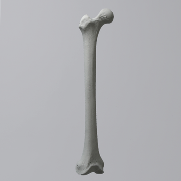Femur, Radiopaque, Right, Medium