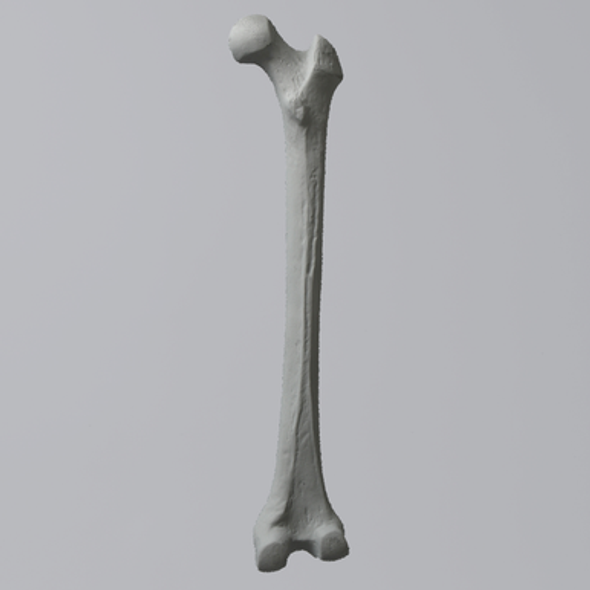 Femur, Radiopaque, Right, Medium