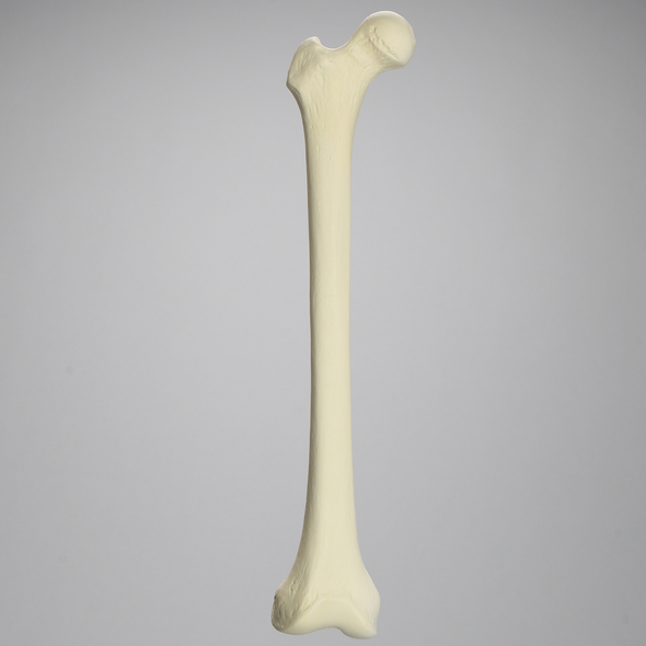 Femur, 15 mm Canal, Foam Cortical, Right, Medium