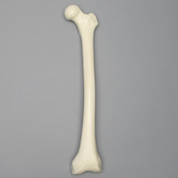 Femur, 11 mm Canal, Foam Cortical, Left, Medium