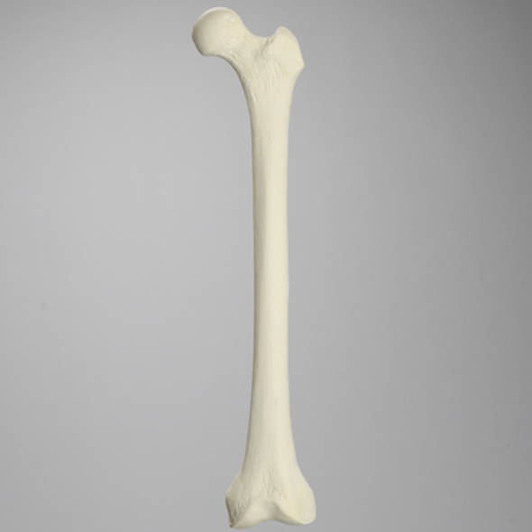 Femur for IM Nail with 15 mm, Foam Cortical, Left, Medium