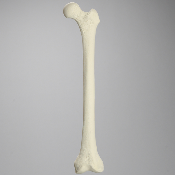 Femur for IM Nail with 15 mm, Foam Cortical, Left, Medium