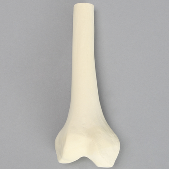 Femur, Distal with 15 mm Canal, Right