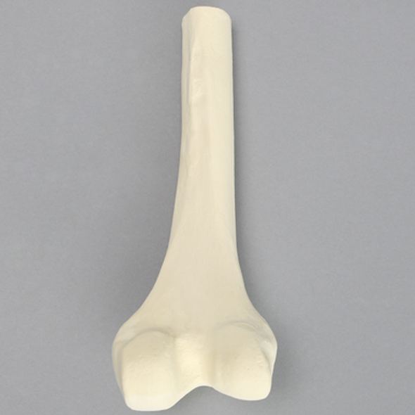 Femur, Distal with 15 mm Canal, Right