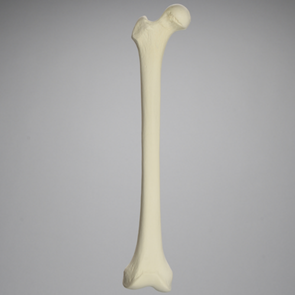 Femur, 15 mm Canal, Solid Foam, Right, Medium