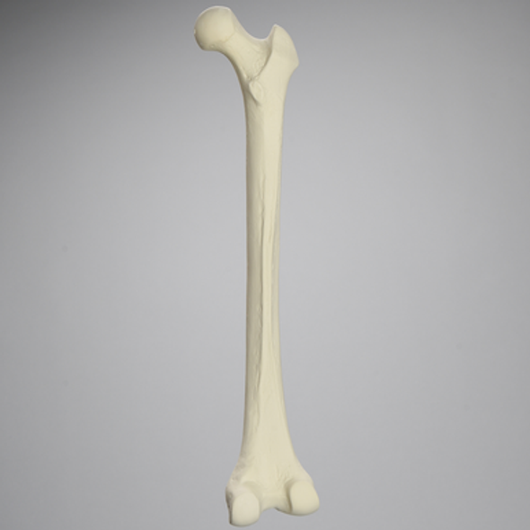 Femur, 15 mm Canal, Solid Foam, Right, Medium
