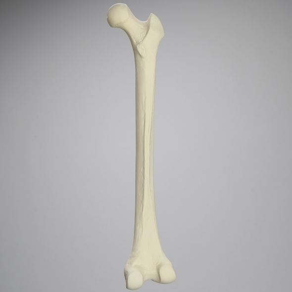 Femur, 15 mm Canal, Solid Foam, Right, Medium