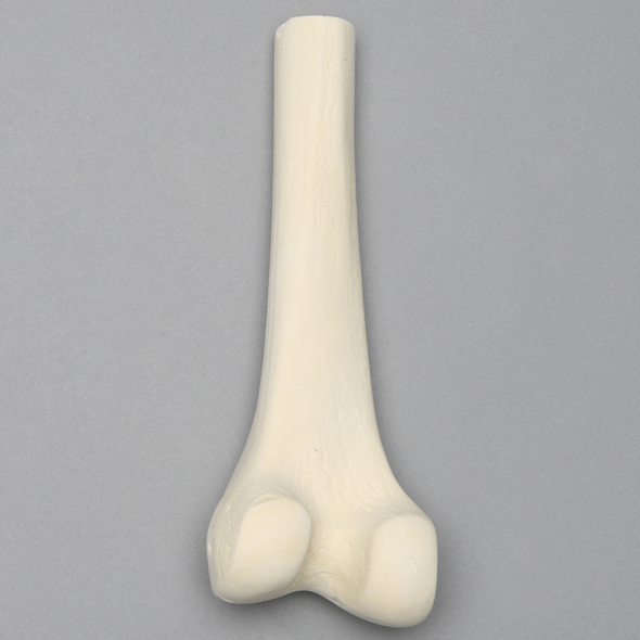 Femur, Distal with 15 mm Canal, Left