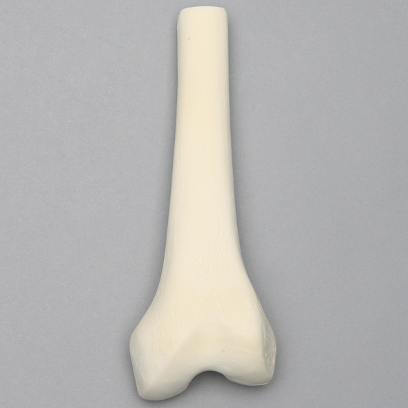 Femur, Distal with 15 mm Canal, Left