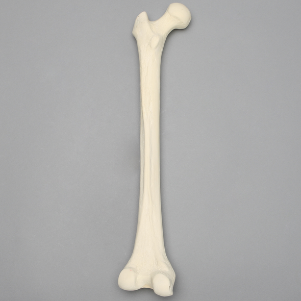 Femur, 15 mm Canal, Solid Foam, Left, Medium