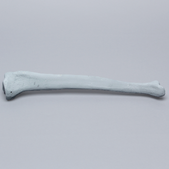 Tibia with Plugged Distal End and Radiopaque Properties, Left