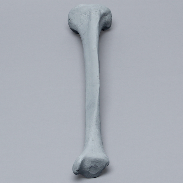 Tibia with Plugged Distal End and Radiopaque Properties, Left