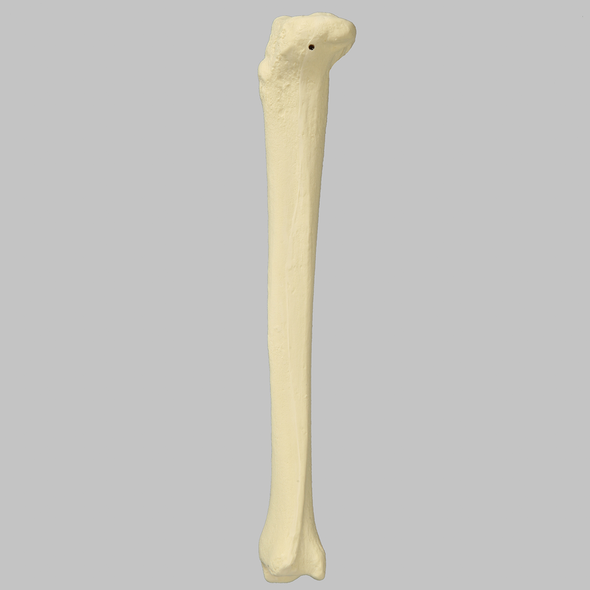 Tibia with 8 mm Canal, Foam Cortical, Left, Small