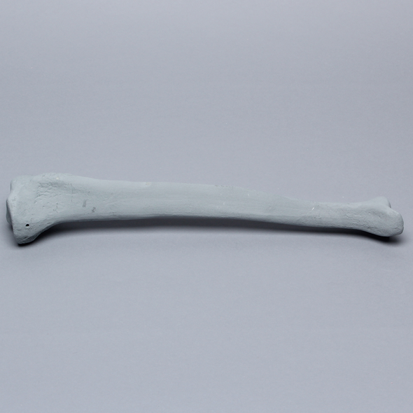 Tibia with Radiopaque Properties, Left, Medium