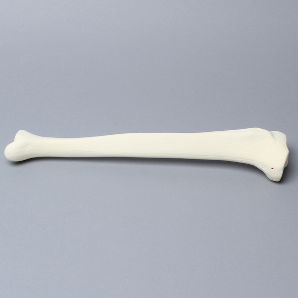 Tibia with 12.7 mm, Foam Cortical, Right, Medium