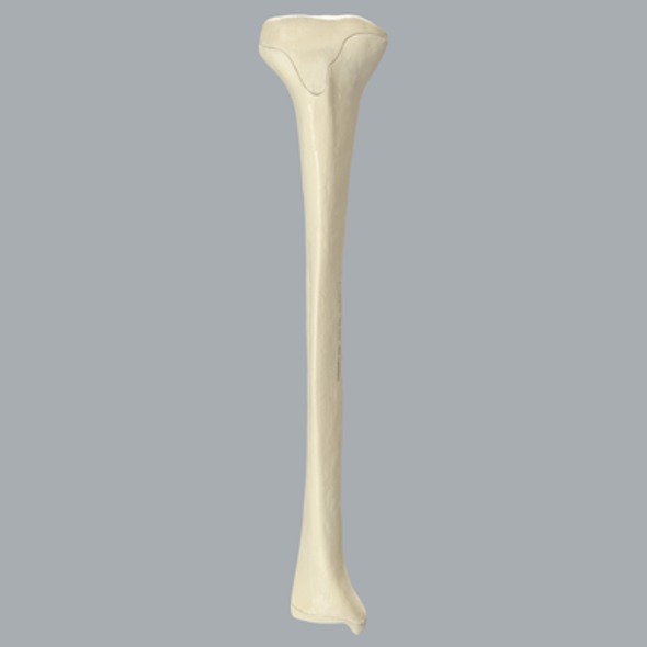 Tibia with Osteoporotic Cortex, Right, Medium