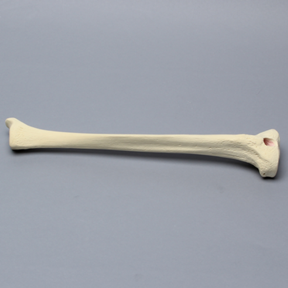 Tibia with 12 mm Entry Site for IM Nail, Left, Medium