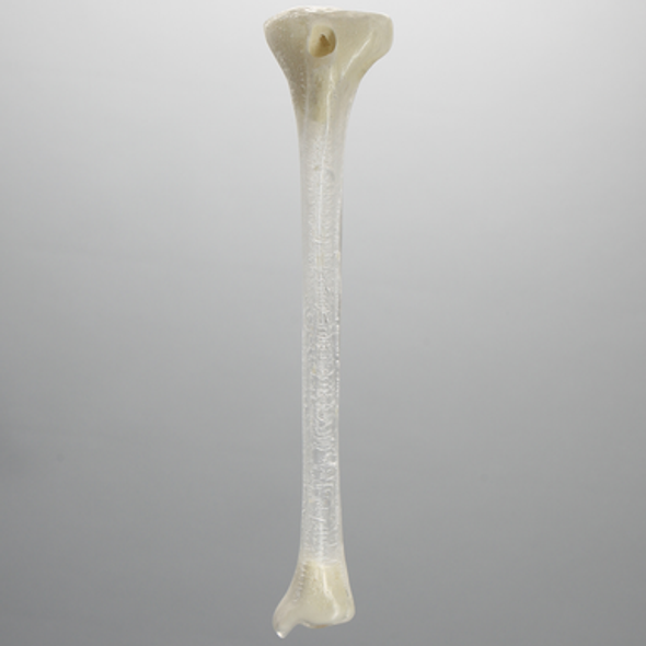 Tibia with 13 mm Entry Site for IM Nail, Left