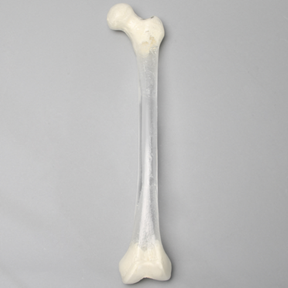 Femur, Transparent with 14 mm Canal, Left
