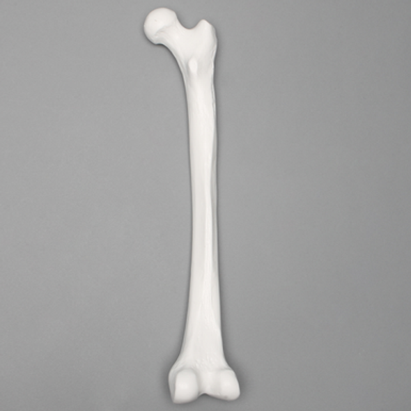 Femur with 15 mm Canal, Plastic Cortical Shell, Right