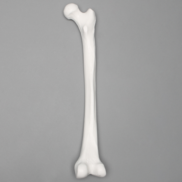 Femur with 15 mm Canal, Plastic Cortical Shell, Right