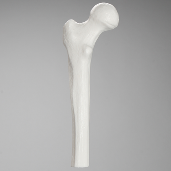 Femur, Plastic Cortical Shell, Proximal