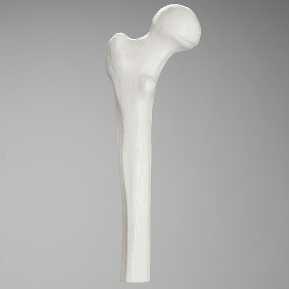 Femur, Plastic Cortical Shell, Proximal