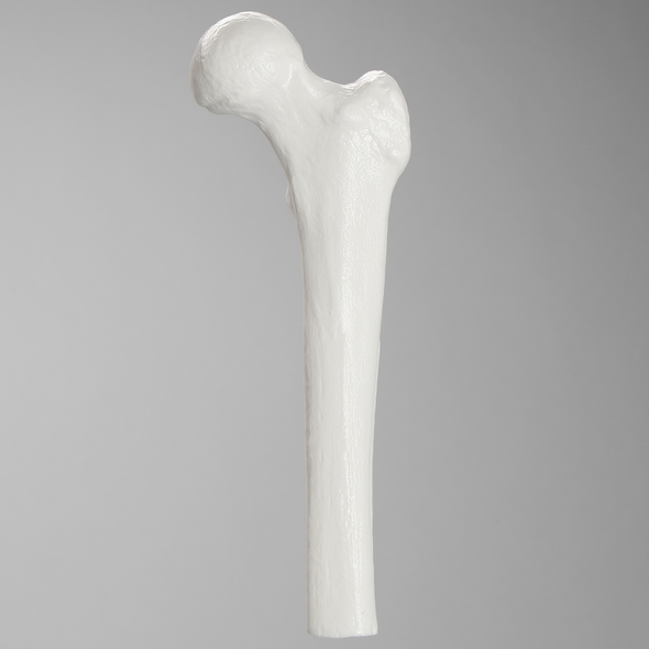 Femur, Plastic Cortical Shell, Proximal