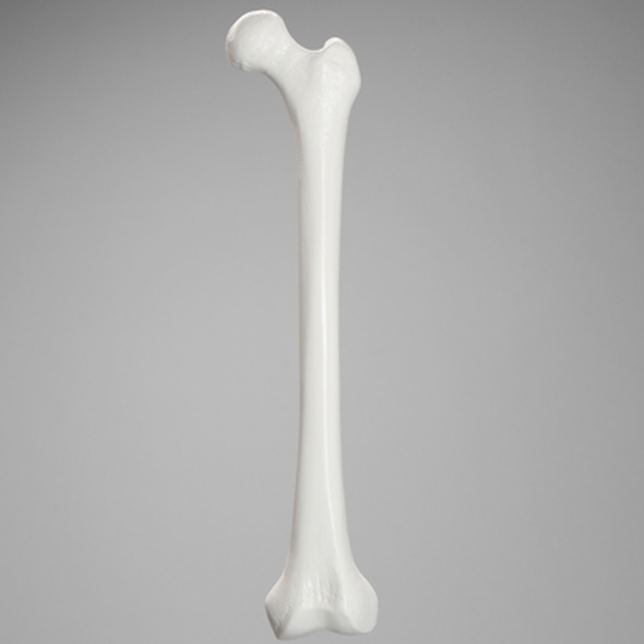 Femur with 12.5 mm Canal, Plastic Cortical Shell, Left