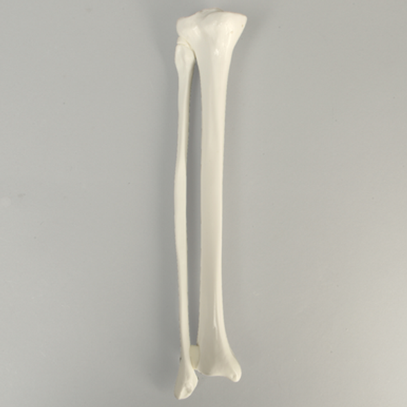 Tibia and Fibula, Plastic Cortical Shell, Medium