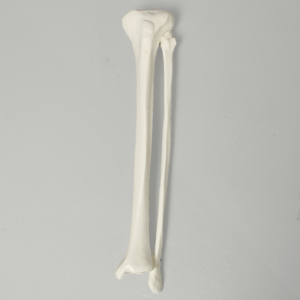 Tibia and Fibula, Plastic Cortical Shell, Medium