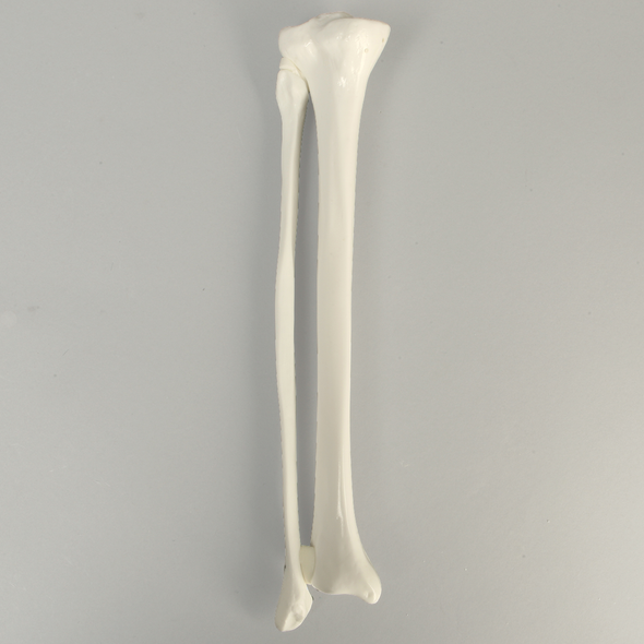 Tibia and Fibula, Plastic Cortical Shell, Medium