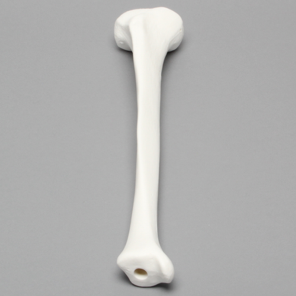 Tibia, Plastic Cortical Shell with 12 mm Canal, Right