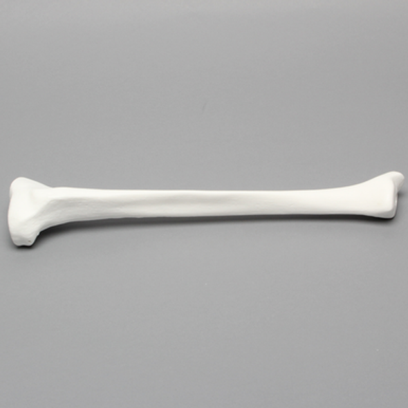 Tibia, Plastic Cortical Shell with 12 mm Canal, Right