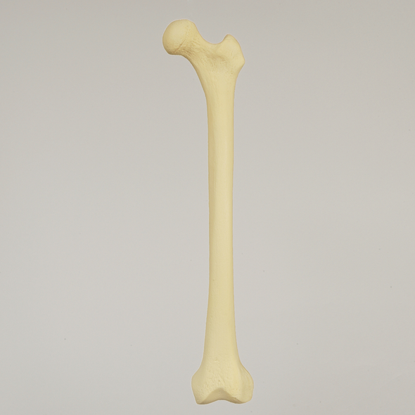 Femur with Narrow Intercondylar Notch, Foam Cortical Shell, Left