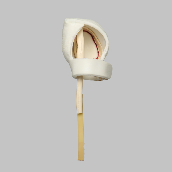 Glenoid Capsule Assembly for 1509 Shoulder Series