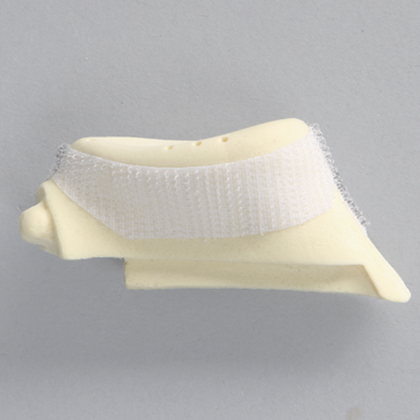 Glenoid with Anchor Tunnels for ALEX II and ALEX III Shoulder Professors
