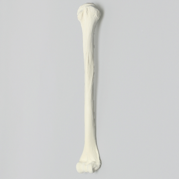 Humerus with 12 mm Proximal Canal, Foam Cortical