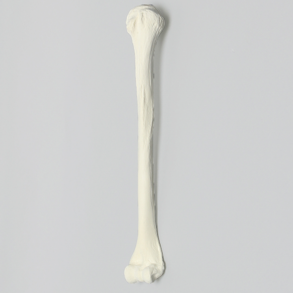 Humerus with 12 mm Proximal Canal, Foam Cortical