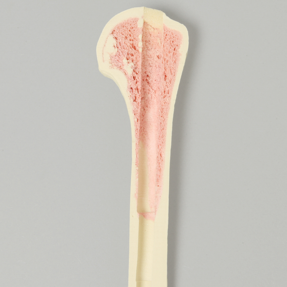 Humerus with 12 mm Proximal Canal, Foam Cortical