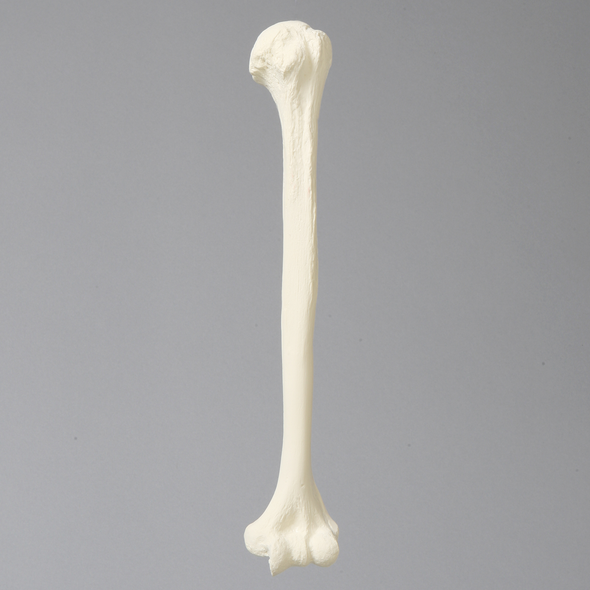 Humerus with 11mm Canal, Foam Cortical