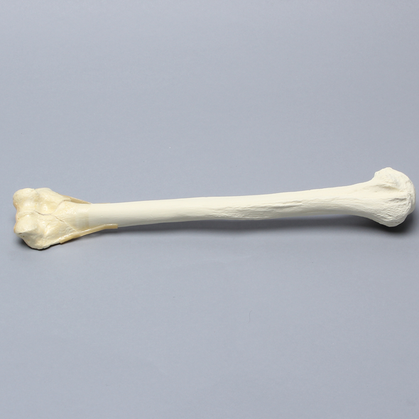 Humerus with "Y" Fracture and Periosteum, Foam Cortical