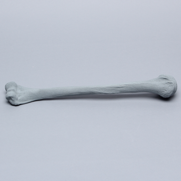 Humerus with Radiopaque Properties