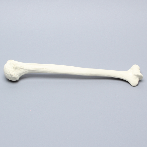 Humerus for IM Nail with 11 mm Entry Site, Foam Cortical