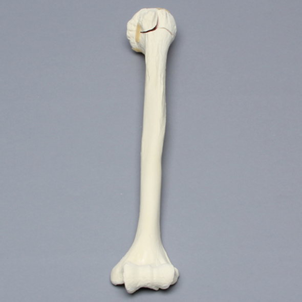 Humerus with Four-Part Bicipital Groove Fracture, Foam Cortical, Left