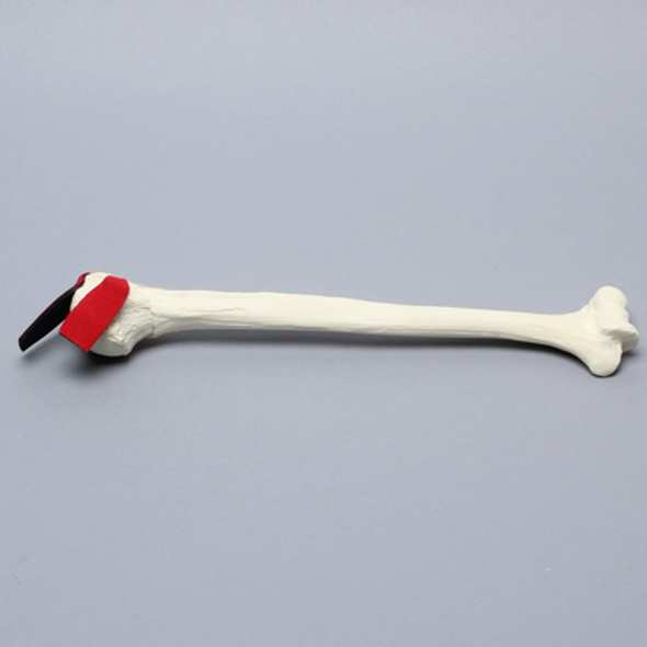 Humerus with Three-Part Head Fracture and Tendon, Foam Cortical