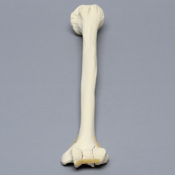 Humerus with "Y" Fracture, Foam Cortical