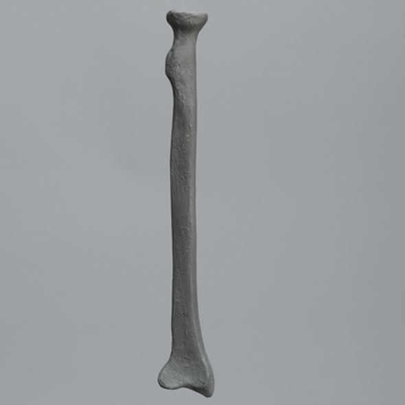 Radius, Radiopaque, Left
